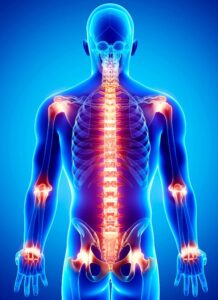 Shimbhala Curcumin - Ayurvedic Medicine for chronic inflammation